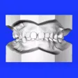 Maxilla
