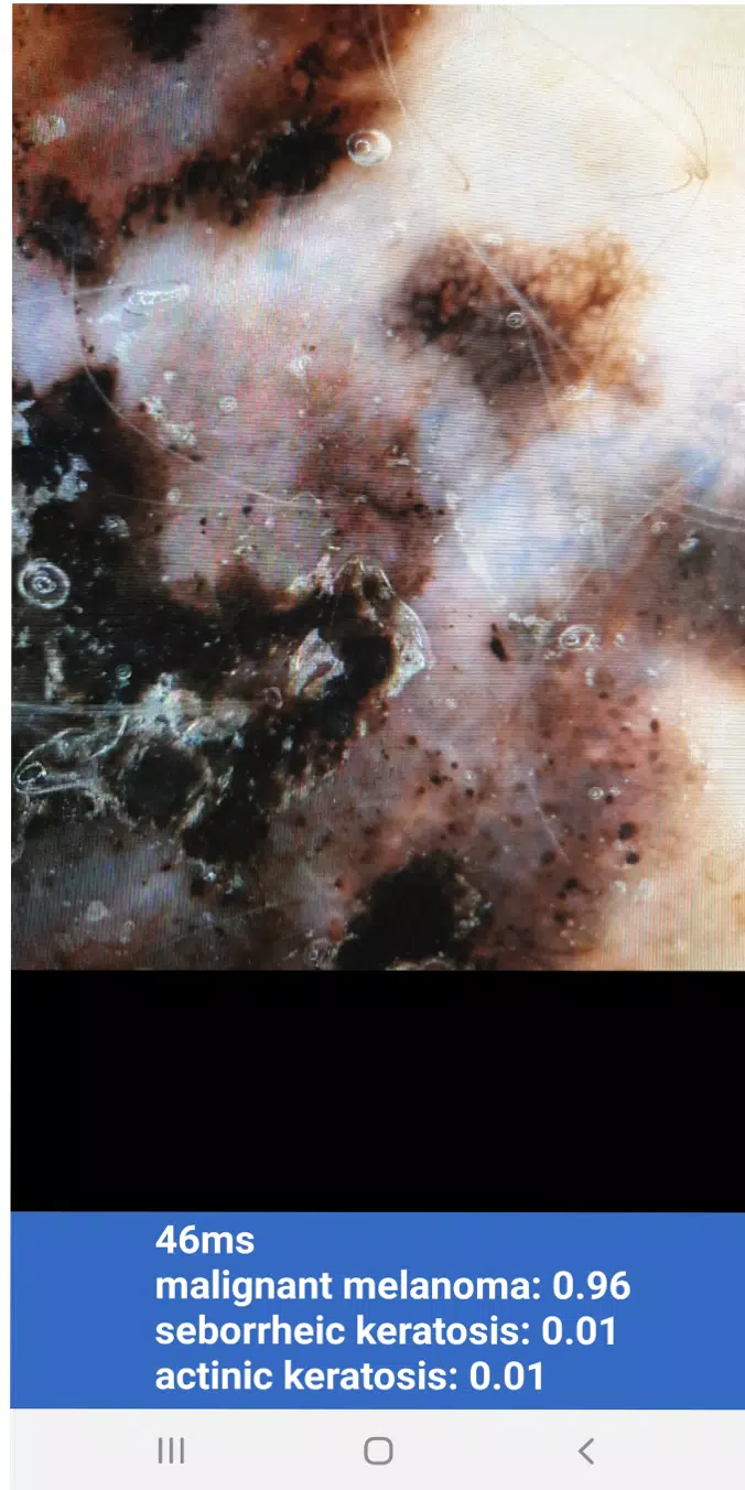 AI Diagnose Screenshots
