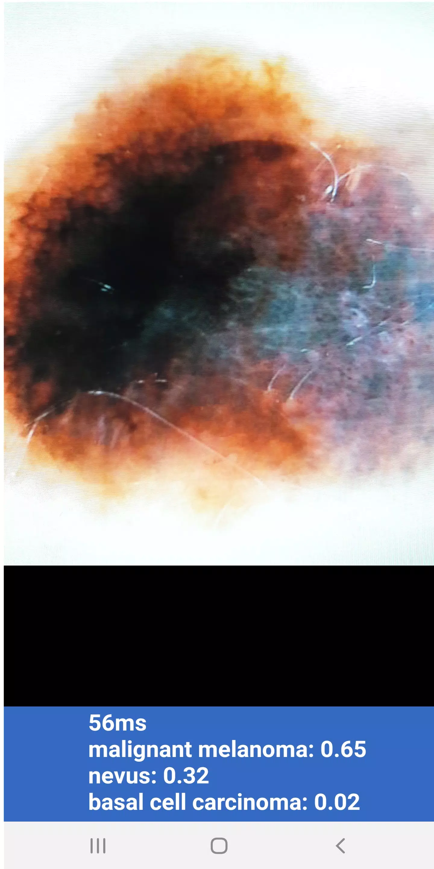 AI Diagnose Screenshots