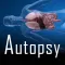 Autopsy