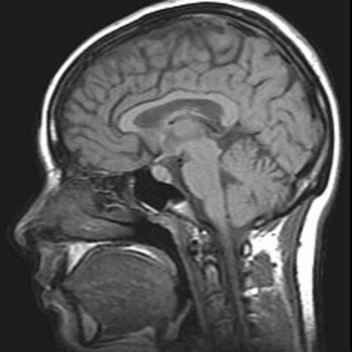 MRI Viewer MRI Viewer