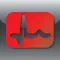 EKG-card