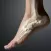 Leg.Fractures