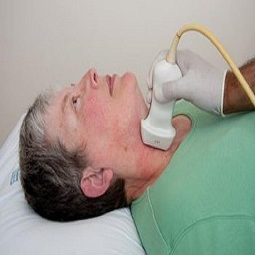Doppler US Of Carotid arteries