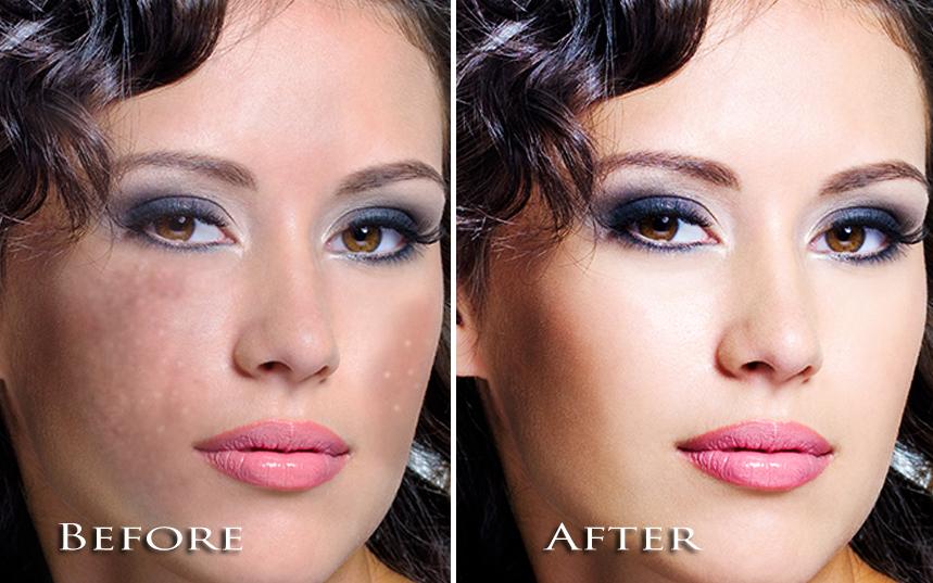 Face Blemishes Removal Screenshots
