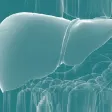 HCV Consensus Statement