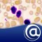 Chronic Lymphocytic Leukemia