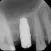 Dental ML