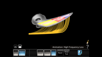 Ear Disorders: Inner Screenshots