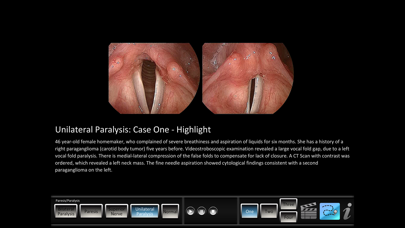 Paresis/Paralysis Screenshots