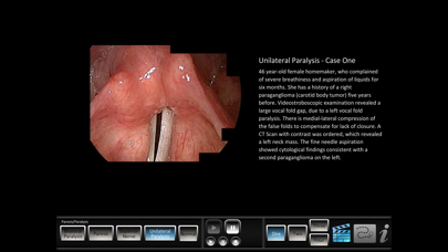 Paresis/Paralysis Screenshots