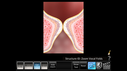 Vocal Folds ID Screenshots