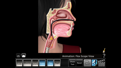 Vocal Folds ID Screenshots