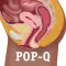 Pop-Q