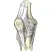 Arthroplasty Size Predictor