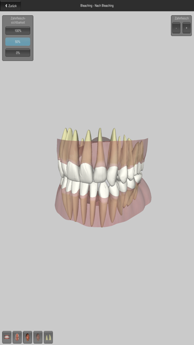 CGM VISODENT 3D App Screenshots