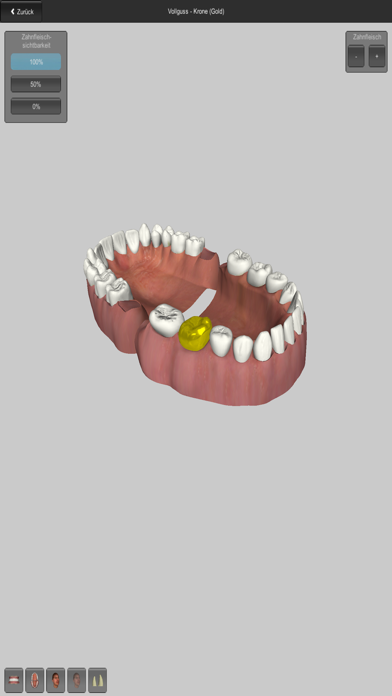 CGM VISODENT 3D App Screenshots