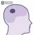 RCP Stroke Guideline 2012 – Patient and Carer