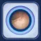 Lower Endoscopy