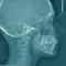 Oral Radiology