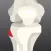 Peroneal Nerve Therapy