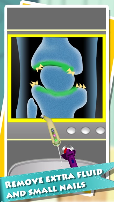 Knee Surgery Simulator - Kids First Aid Helper Game Screenshots