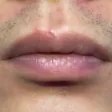 MouthRis