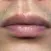 MouthRis