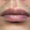 MouthRis