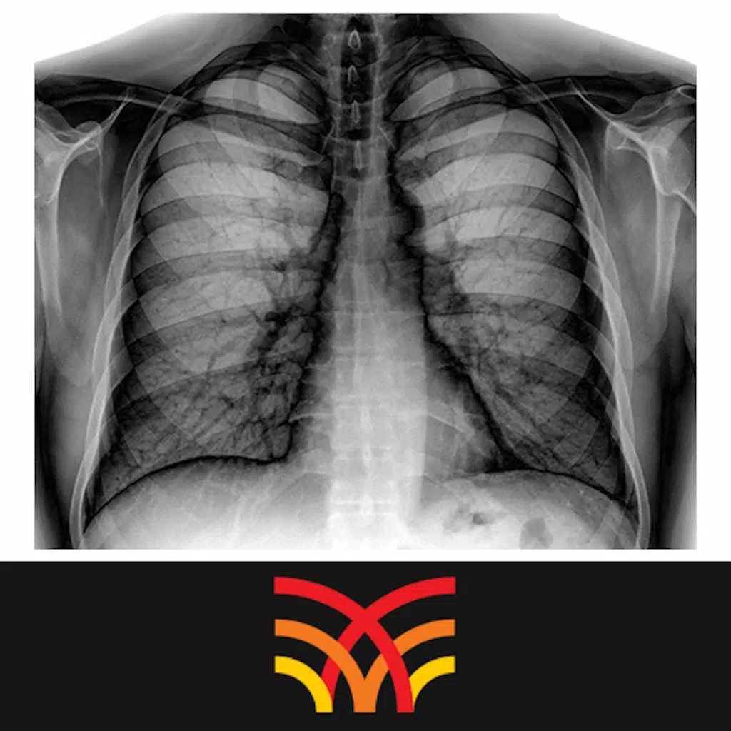 Chest Radiographs Chest Radiographs