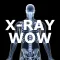 X-Ray Wow
