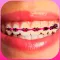 Braces Photo Editor - Stickers