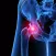 Septic Hip