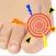 Gout Diagnosis
