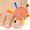 Gout Diagnosis