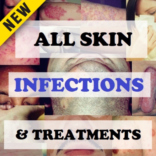 Skin Infections and Treatments Skin Infections and Treatments
