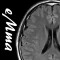 DICOM Viewer : eMma