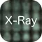 X-Ray Differential Diagnosis