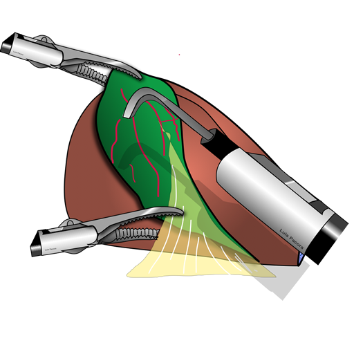 COLELAP