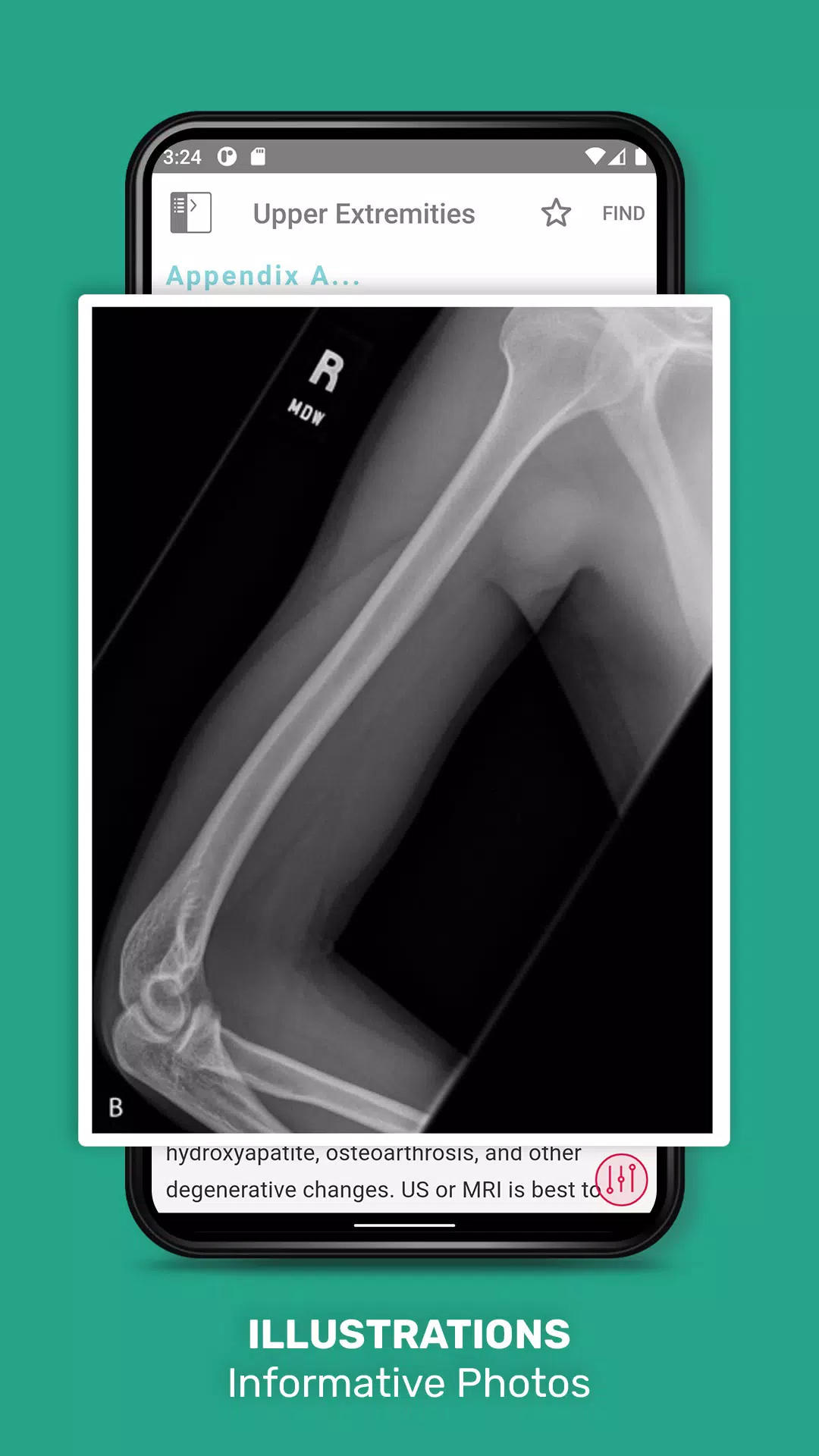 5 Min Sports Medicine Consult Screenshots