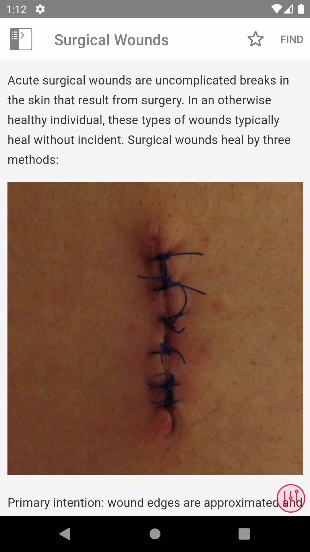Wound Care MI Visual Screenshots
