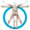IORT - Shoulder Arthroplasty