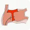 TRANSEPTAID