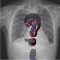 Medications in Radiology