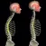 Kyphosis & Rounded Back