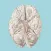 Cerebrovascular & Stroke: WTD