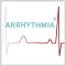 Arrhytmia AR