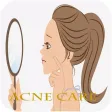 Acne Care Giude- Best Pimple Treatment Tips