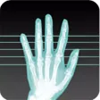 X-Ray Scanner -free