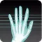 X-Ray Scanner -free